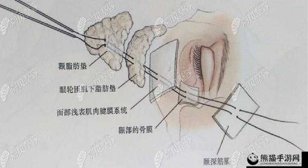 八爪鱼紧缩术：探索其独特魅力与应用价值